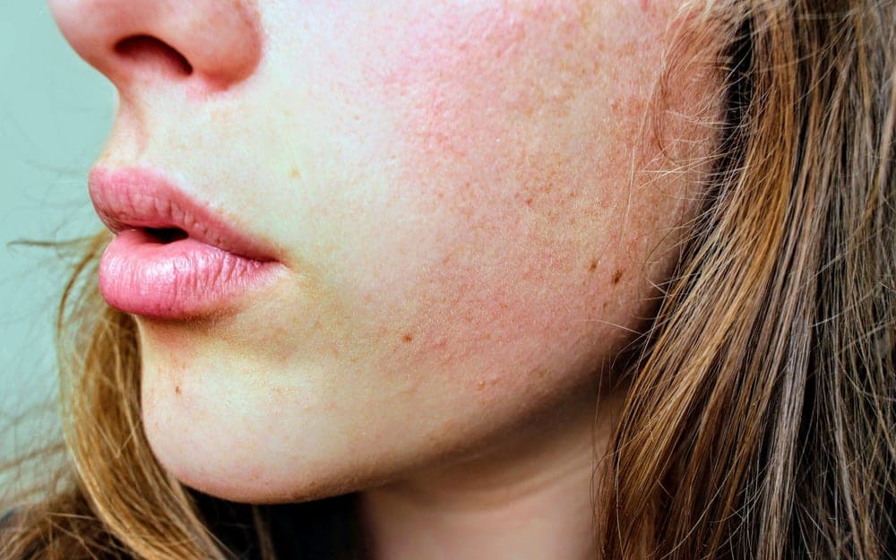 Natural, healthy-looking skin